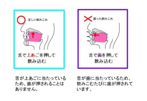 20140131141029