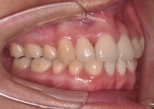 イメージがありません