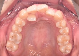 イメージがありません