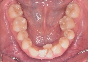 イメージがありません