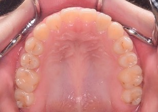 イメージがありません