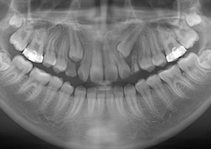 イメージがありません