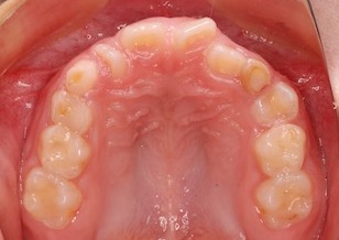 イメージがありません