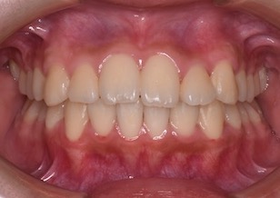 イメージがありません