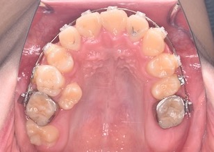 イメージがありません