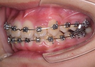 イメージがありません