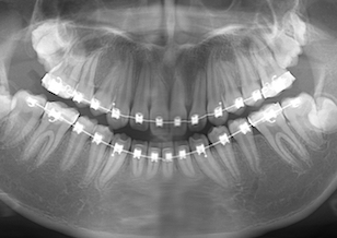 イメージがありません