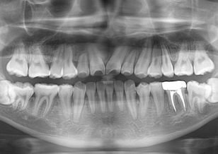 イメージがありません