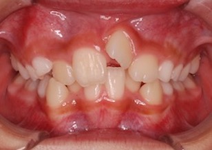 イメージがありません