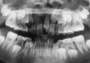 イメージがありません