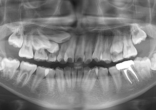 イメージがありません