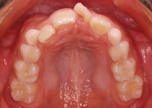 イメージがありません