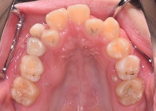 イメージがありません