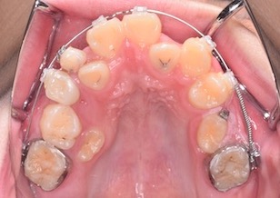 イメージがありません