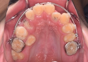 イメージがありません